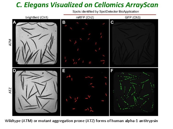 C. Elegans Visualized on Cellomics Array. Scan Wildtype (ATM) or mutant aggregation prone (ATZ)