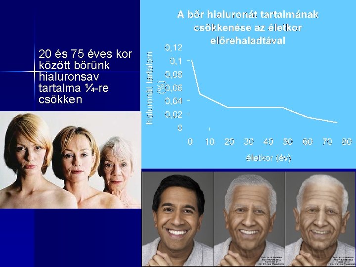 20 és 75 éves kor között bőrünk hialuronsav tartalma ¼-re csökken 