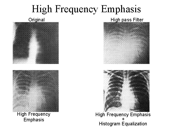 High Frequency Emphasis Original High Frequency Emphasis High pass Filter High Frequency Emphasis +