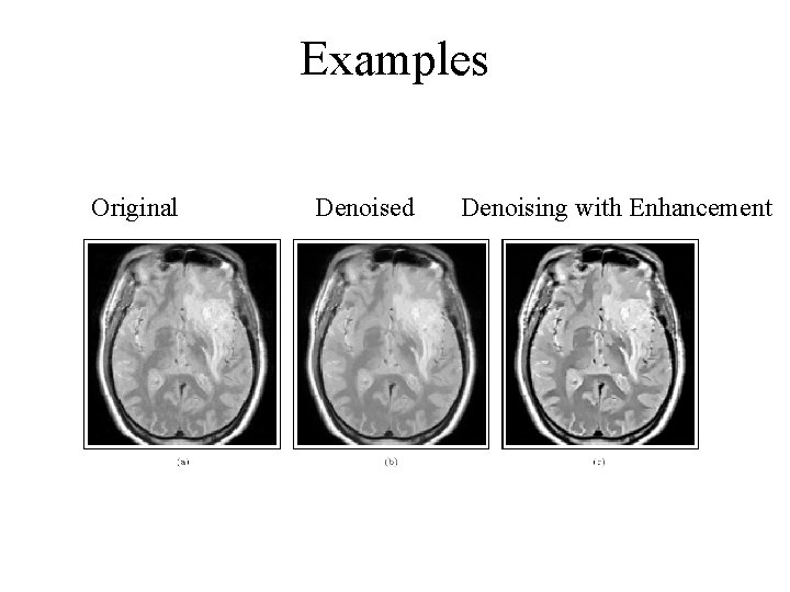 Examples Original Denoised Denoising with Enhancement 