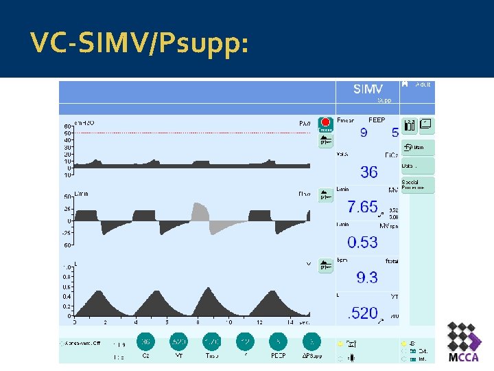 VC-SIMV/Psupp: 