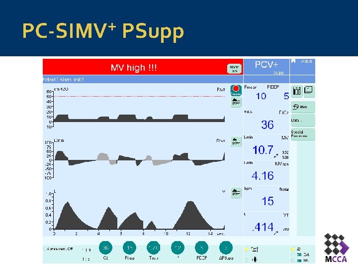 + PC-SIMV PSupp + PC-SIMV PSupp