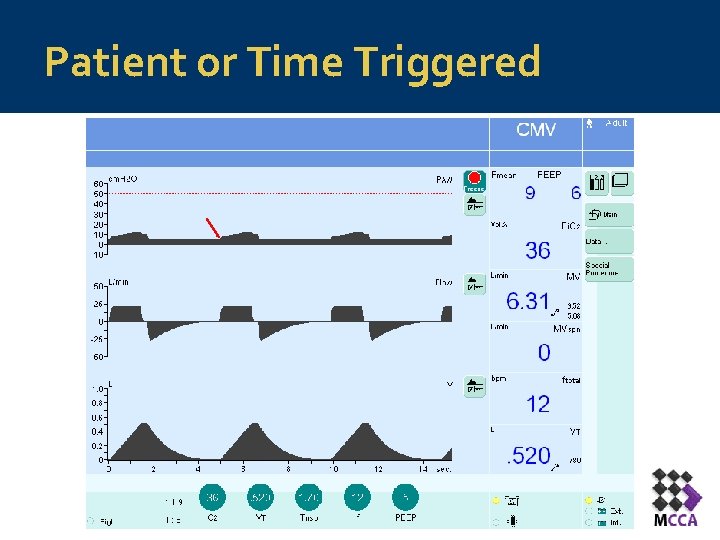 Patient or Time Triggered 