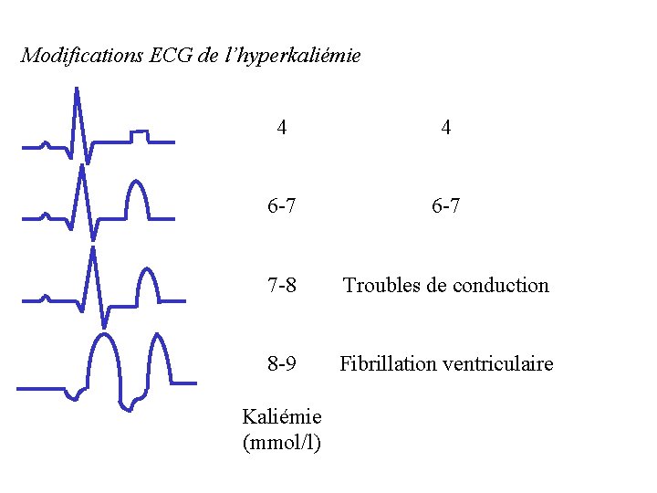 Modifications ECG de l’hyperkaliémie 4 4 6 -7 7 -8 Troubles de conduction 8