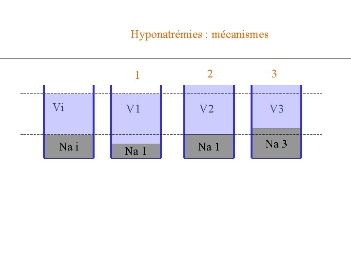 Hyponatrémies : mécanismes Vi Na i 1 2 3 V 1 V 2 V