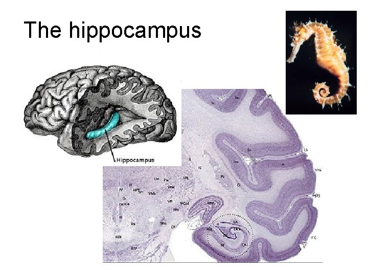 The hippocampus 