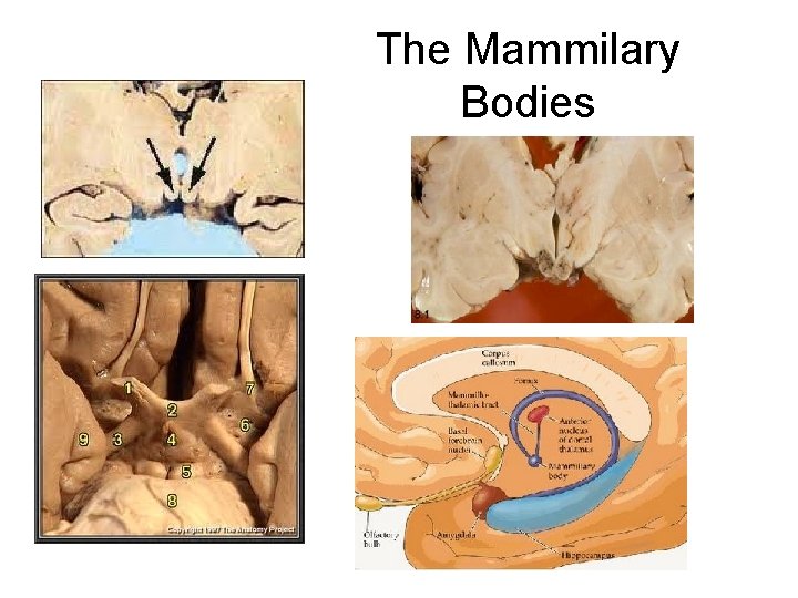 The Mammilary Bodies 