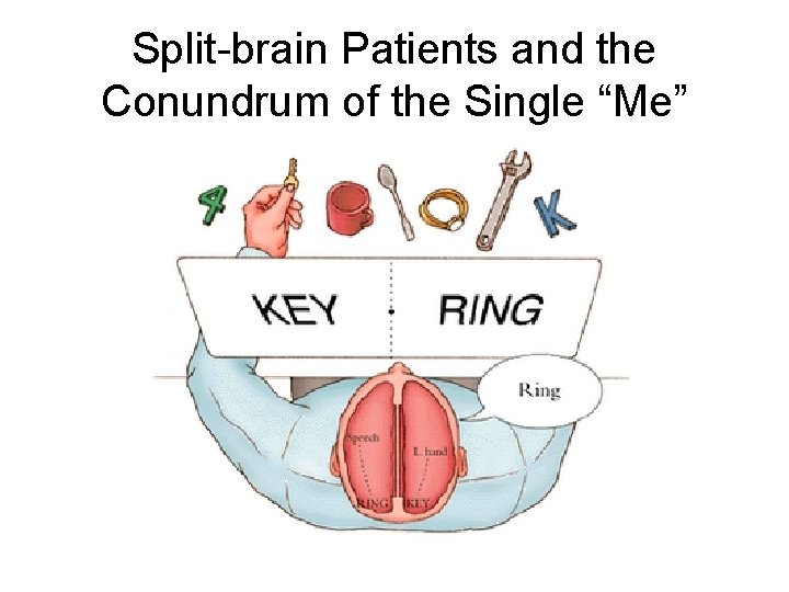 Split-brain Patients and the Conundrum of the Single “Me” 