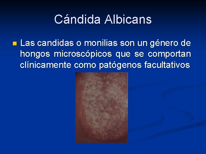 Cándida Albicans n Las candidas o monilias son un género de hongos microscópicos que