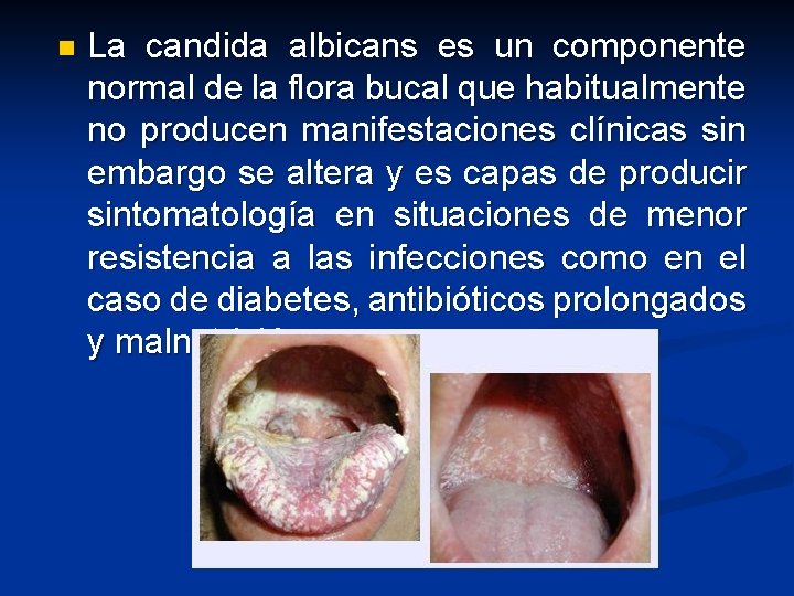 n La candida albicans es un componente normal de la flora bucal que habitualmente