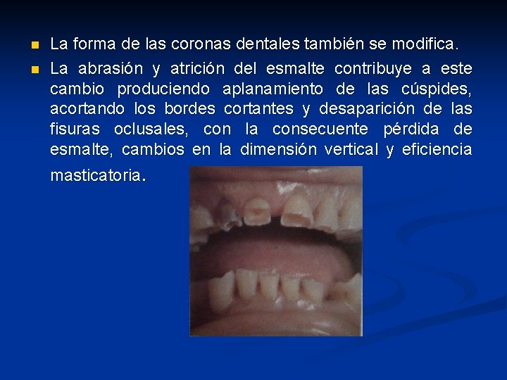 n n La forma de las coronas dentales también se modifica. La abrasión y