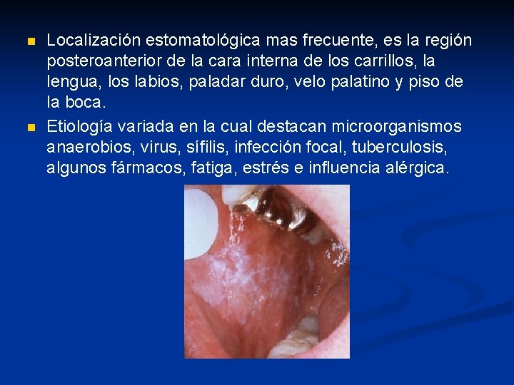 n n Localización estomatológica mas frecuente, es la región posteroanterior de la cara interna