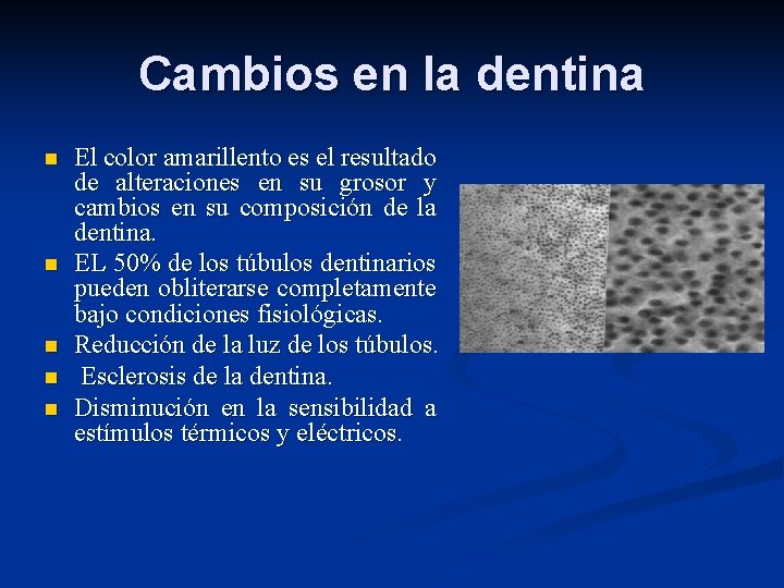 Cambios en la dentina n n n El color amarillento es el resultado de