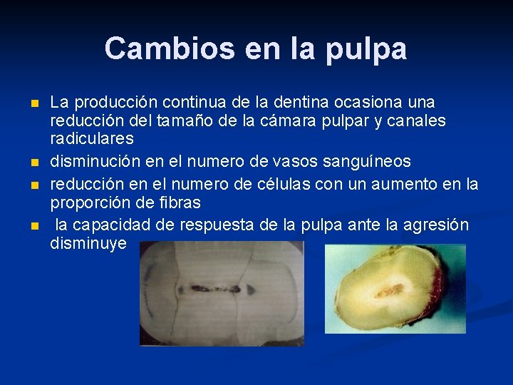 Cambios en la pulpa n n La producción continua de la dentina ocasiona una