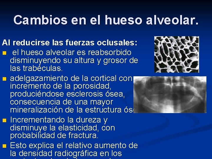 Cambios en el hueso alveolar. Al reducirse las fuerzas oclusales: n el hueso alveolar