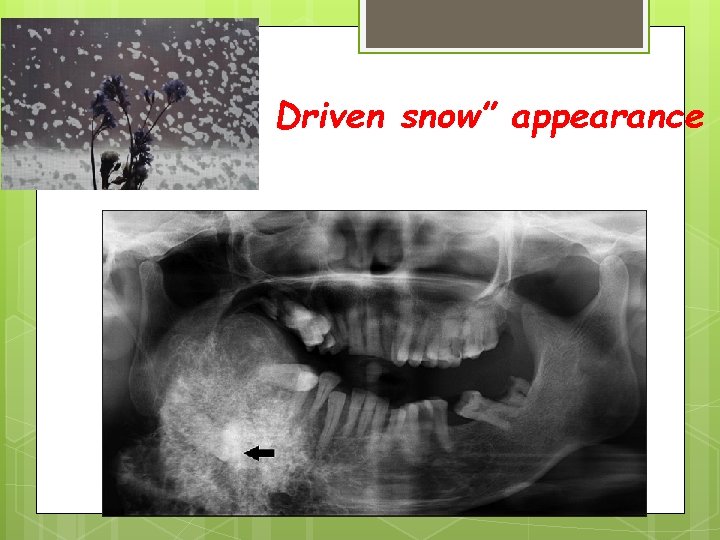 Driven snow” appearance 