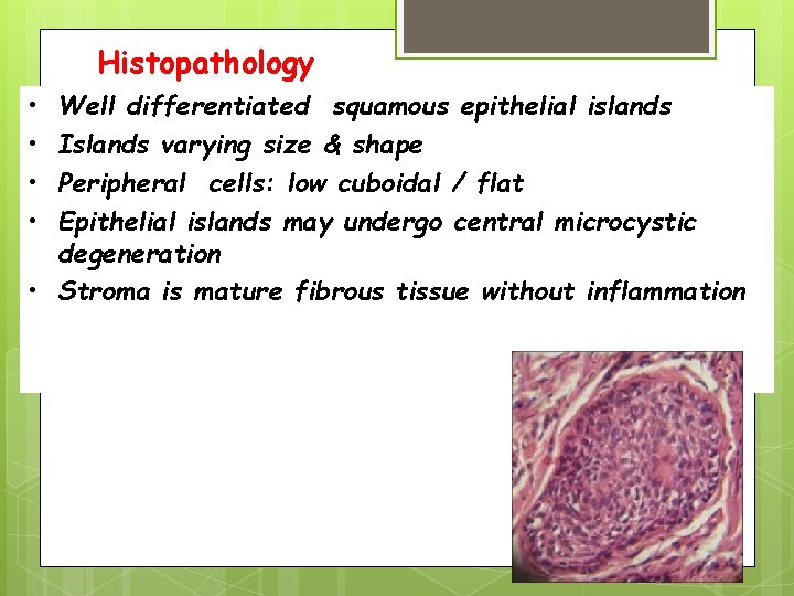 Histopathology • • Well differentiated squamous epithelial islands Islands varying size & shape Peripheral