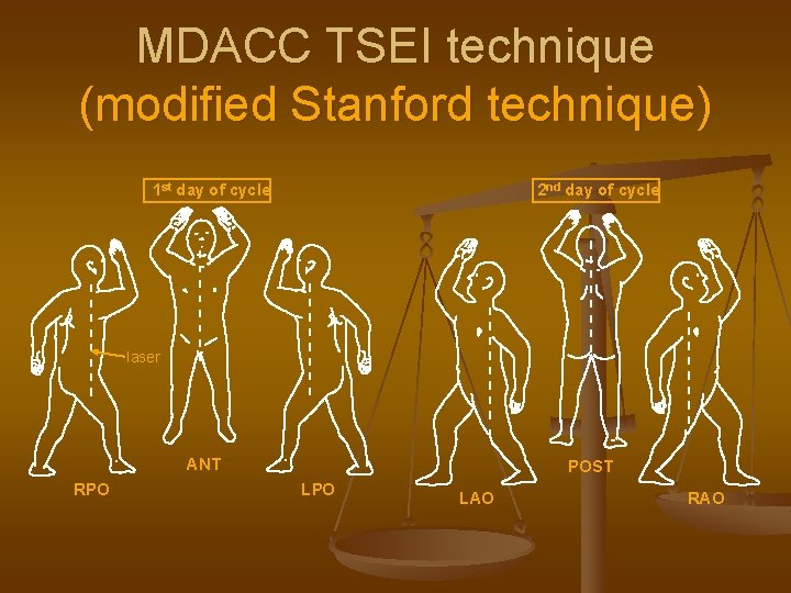 MDACC TSEI technique (modified Stanford technique) 1 st day of cycle 2 nd day