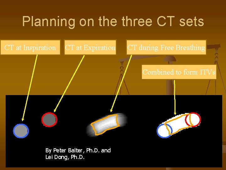 Planning on the three CT sets CT at Inspiration CT at Expiration CT during