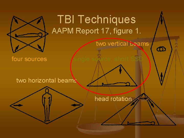 TBI Techniques AAPM Report 17, figure 1. two vertical beams four sources single source,