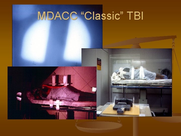 MDACC “Classic” TBI 