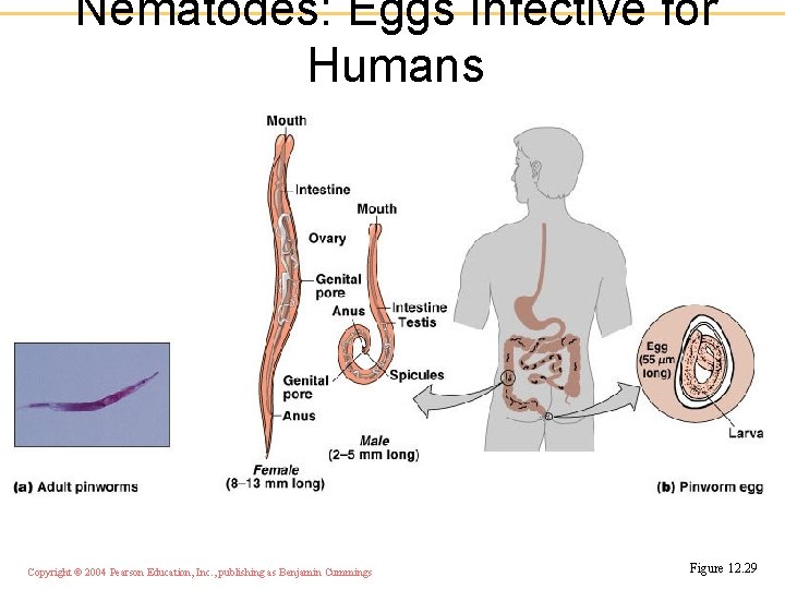 Nematodes: Eggs Infective for Humans Copyright © 2004 Pearson Education, Inc. , publishing as