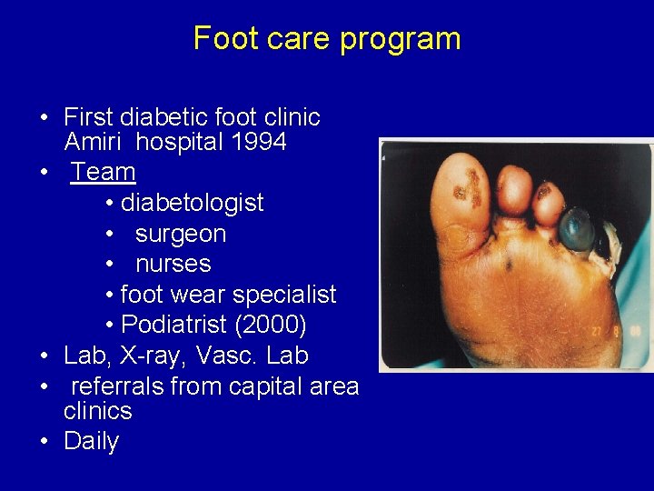Foot care program • First diabetic foot clinic Amiri hospital 1994 • Team •