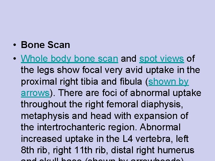  • Bone Scan • Whole body bone scan and spot views of the