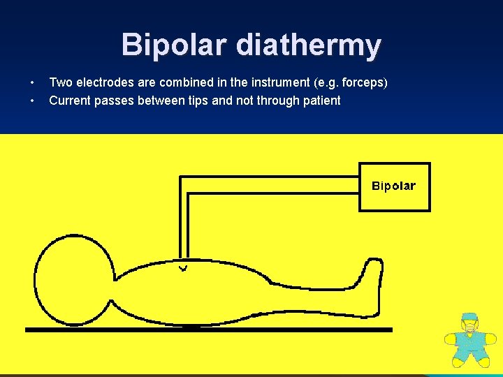 Bipolar diathermy • • Two electrodes are combined in the instrument (e. g. forceps)