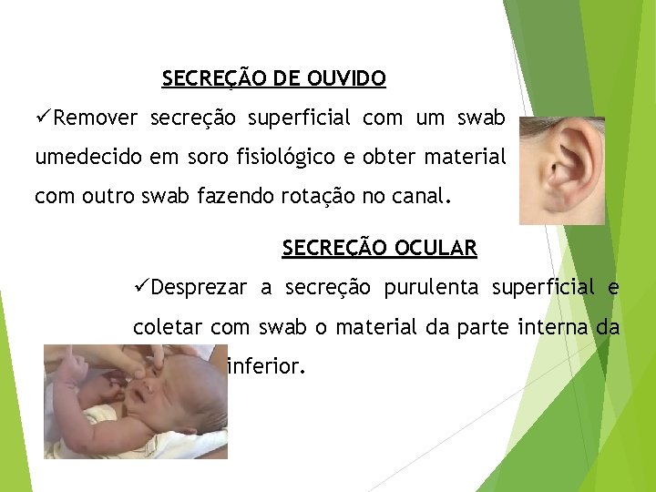 SECREÇÃO DE OUVIDO üRemover secreção superficial com um swab umedecido em soro fisiológico e