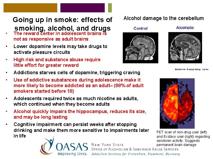  • Going up in smoke: effects of smoking, alcohol, and drugs Alcohol damage