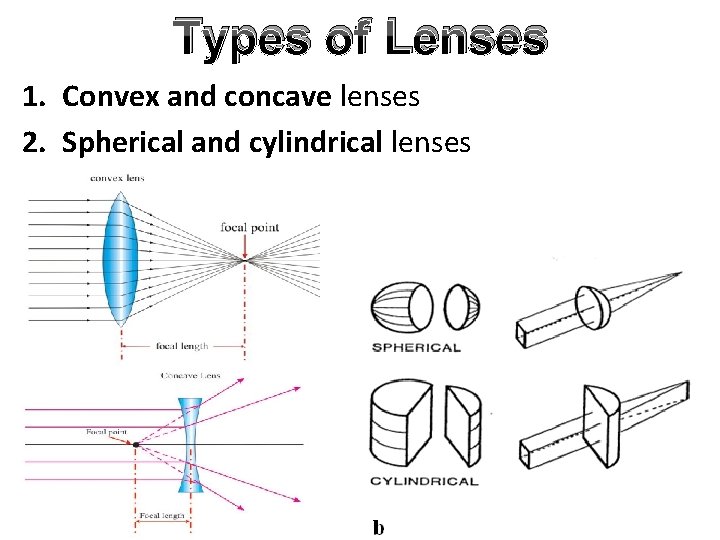 Types of Lenses 1. Convex and concave lenses 2. Spherical and cylindrical lenses Types of Lenses 1. Convex and concave lenses 2. Spherical and cylindrical lenses