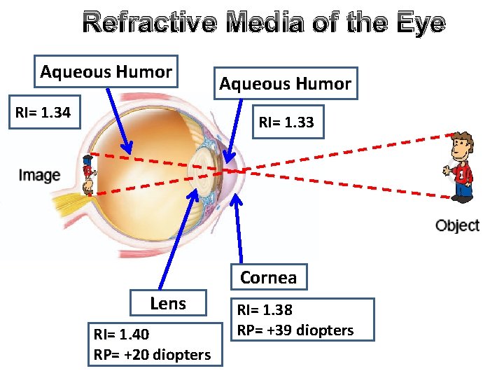 Refractive Media of the Eye Aqueous Humor RI= 1. 34 Aqueous Humor RI= 1. Refractive Media of the Eye Aqueous Humor RI= 1. 34 Aqueous Humor RI= 1.
