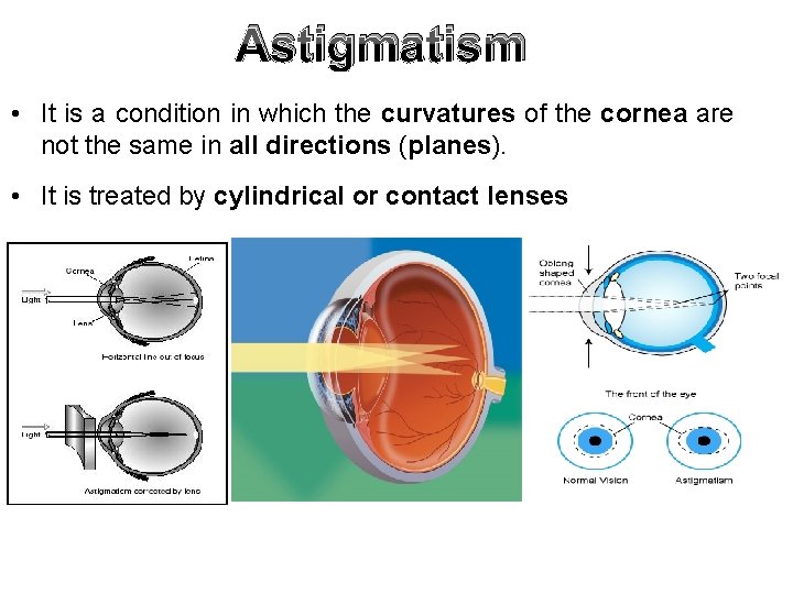 Astigmatism • It is a condition in which the curvatures of the cornea are Astigmatism • It is a condition in which the curvatures of the cornea are