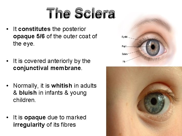 The Sclera • It constitutes the posterior opaque 5/6 of the outer coat of