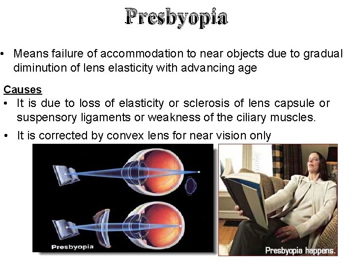 Presbyopia • Means failure of accommodation to near objects due to gradual diminution of