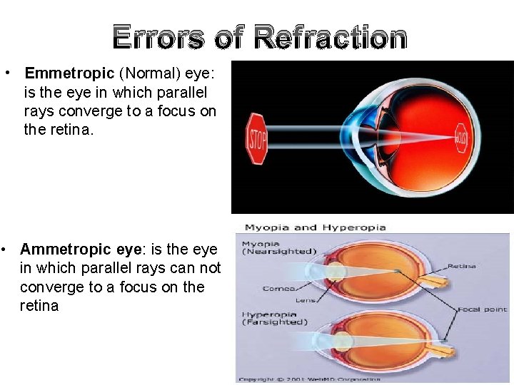 Errors of Refraction • Emmetropic (Normal) eye: is the eye in which parallel rays