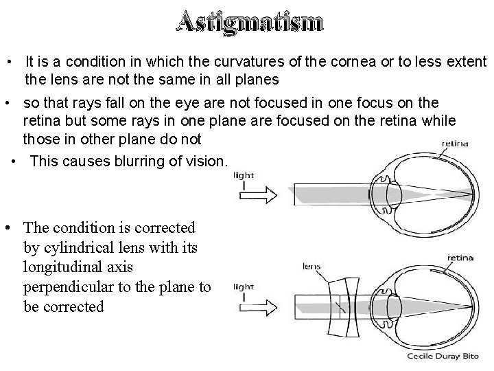 Astigmatism • It is a condition in which the curvatures of the cornea or