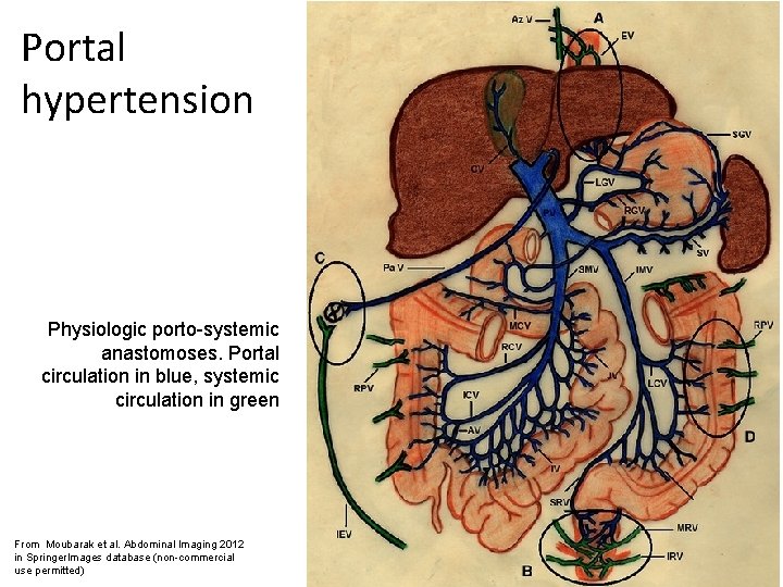 Portal hypertension Physiologic porto-systemic anastomoses. Portal circulation in blue, systemic circulation in green From