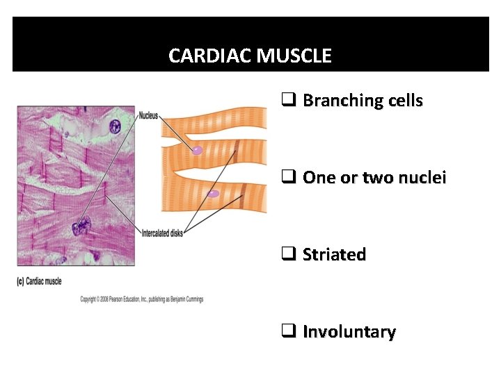 CARDIAC MUSCLE q Branching cells q One or two nuclei q Striated q Involuntary CARDIAC MUSCLE q Branching cells q One or two nuclei q Striated q Involuntary