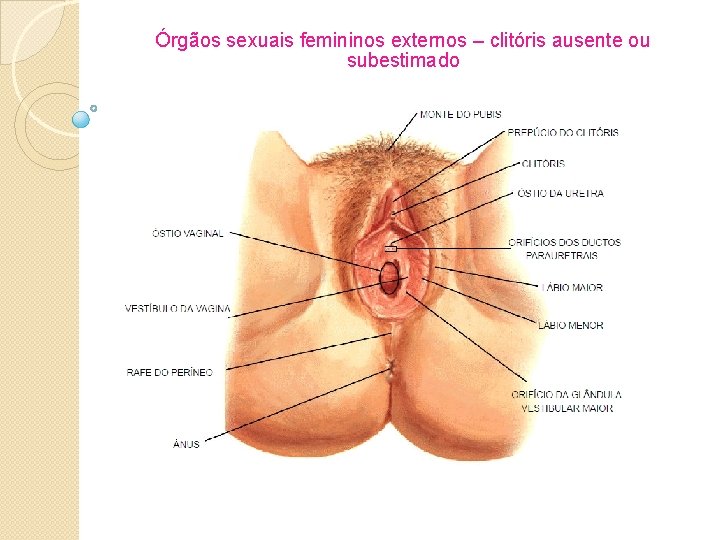 Órgãos sexuais femininos externos – clitóris ausente ou subestimado 