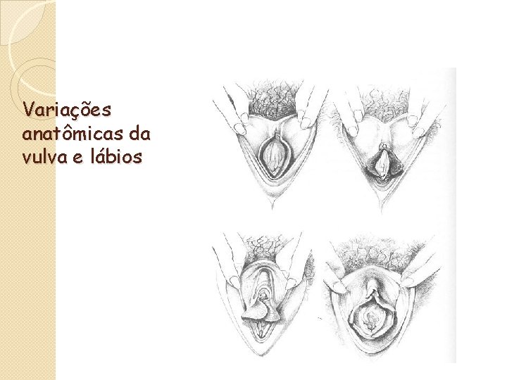 Variações anatômicas da vulva e lábios 