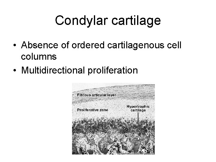 Condylar cartilage • Absence of ordered cartilagenous cell columns • Multidirectional proliferation 