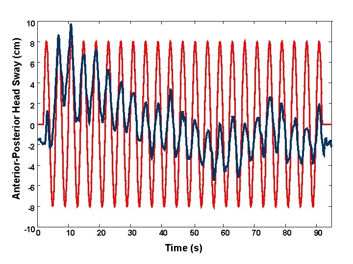 Anterior-Posterior Head Sway (cm) 10 8 6 4 2 0 -2 -4 -6 -8