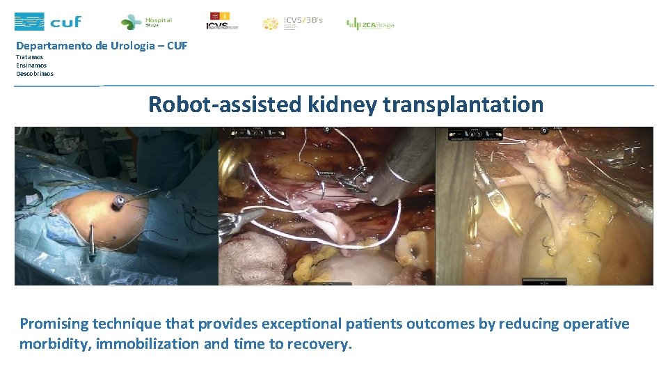 Departamento de Urologia – CUF Tratamos Ensinamos Descobrimos Robot-assisted kidney transplantation Promising technique that