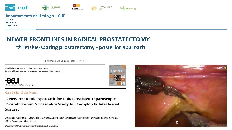 Departamento de Urologia – CUF Tratamos Ensinamos Descobrimos NEWER FRONTLINES IN RADICAL PROSTATECTOMY retzius-sparing