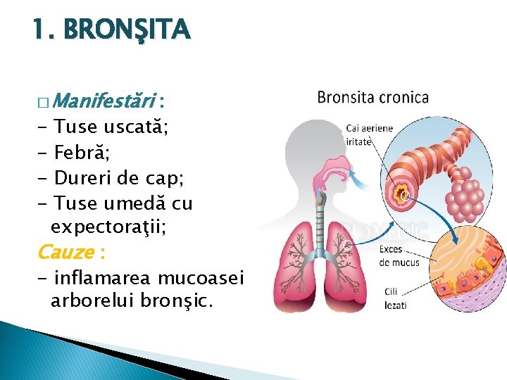 1. BRONŞITA � Manifestări : - Tuse uscată; - Febră; - Dureri de cap;