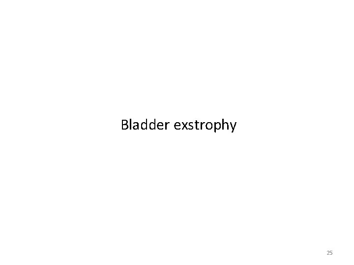 Bladder exstrophy 25 