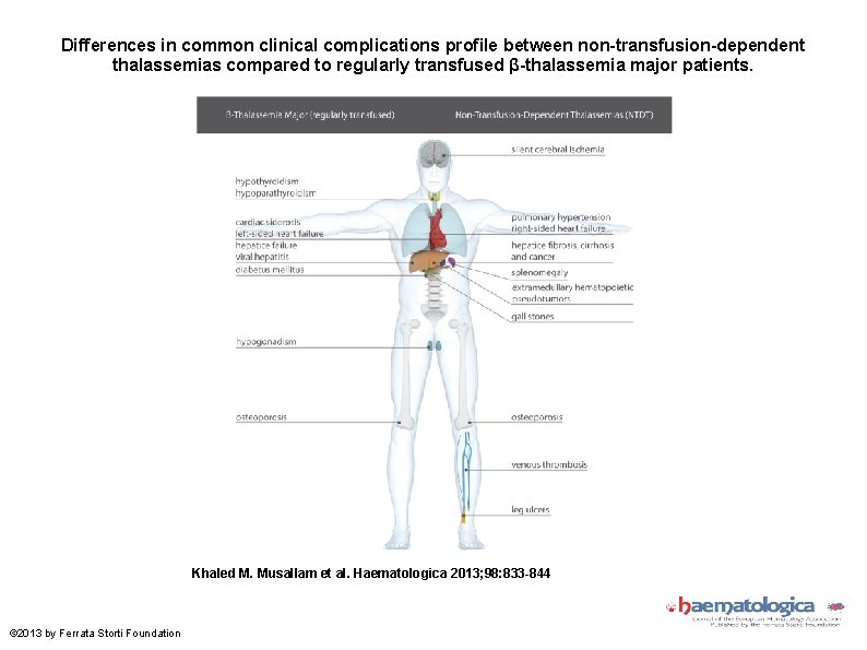 Differences in common clinical complications profile between non-transfusion-dependent thalassemias compared to regularly transfused β-thalassemia