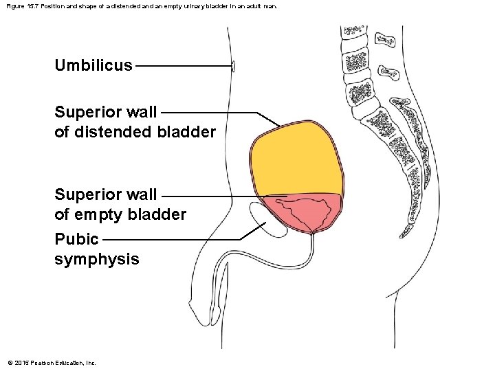 Figure 15. 7 Position and shape of a distended an empty urinary bladder in